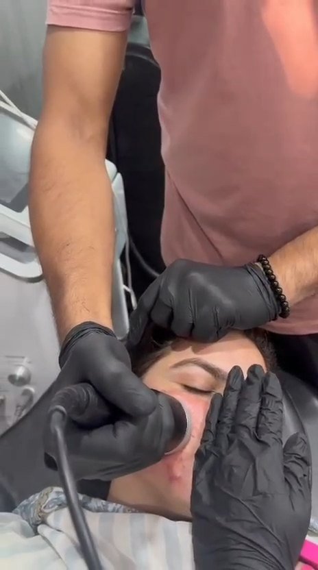 Facial Skin Treatment Procedure Video Thumbnail