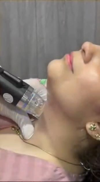Hair PRP Treatment Demo Video Thumbnail