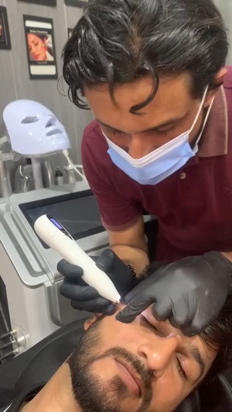 Hair Restoration Treatment Video Thumbnail