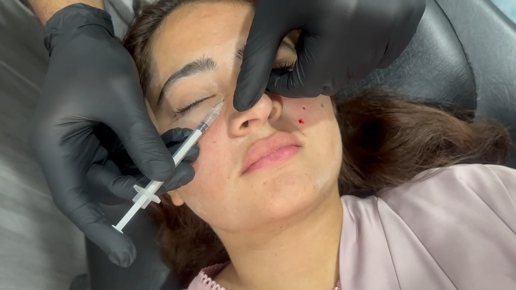Patient Treatment Experience Video Thumbnail