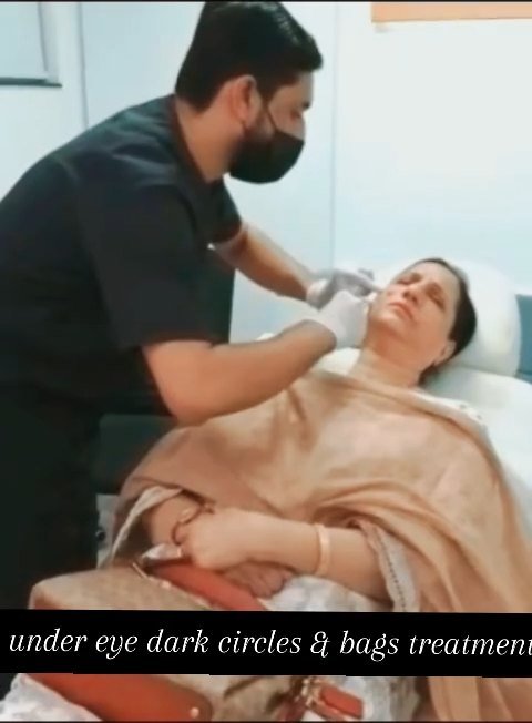 Under-Eye Dark Circle Treatment Video Thumbnail