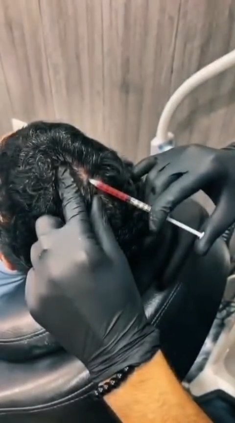 Under-Eye Treatment Procedure Video Thumbnail